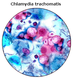 AccuPid Chlamydia trachomatis & Neisserice gonorrhoeae Detection Kit