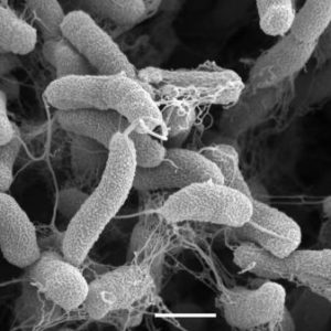 AccuPid Vibrio cholerae Detection Kit